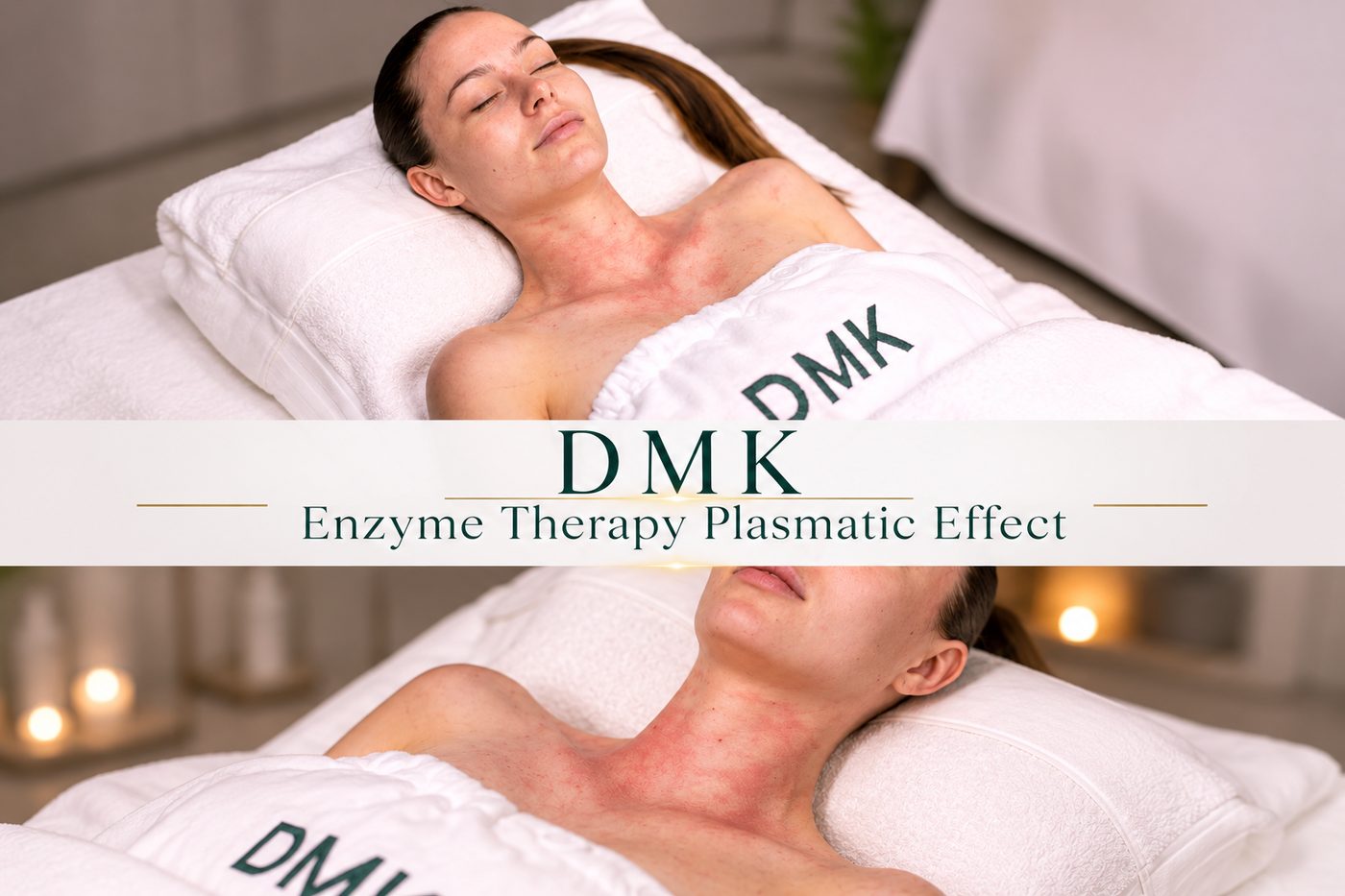 DMK